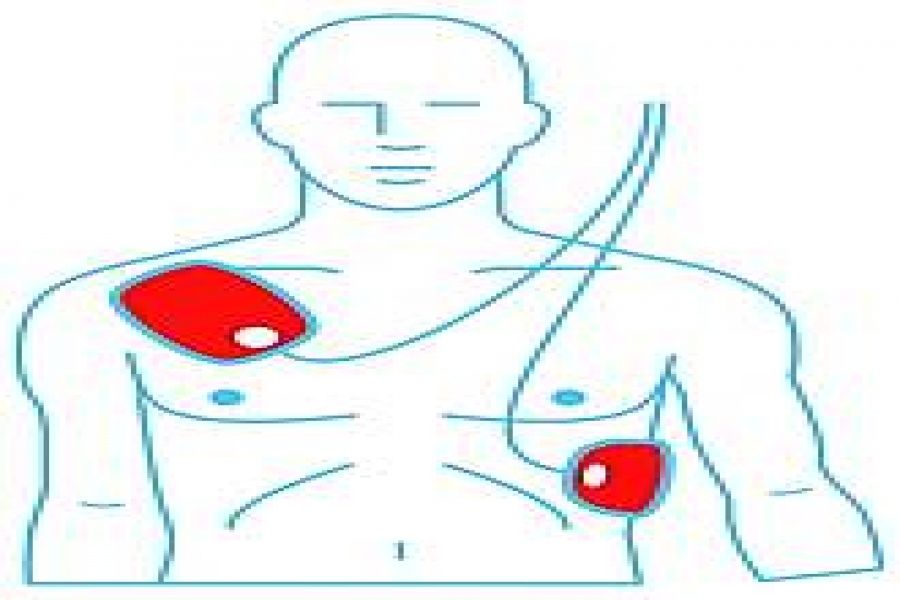 Houdbaarheid van AED elektroden