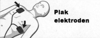 Elektroden plakken op volwassene